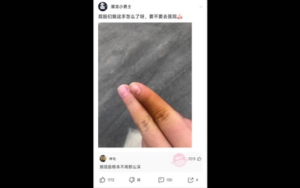 我是狗看见？就？